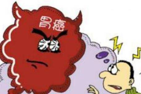 胃癌的早期症状