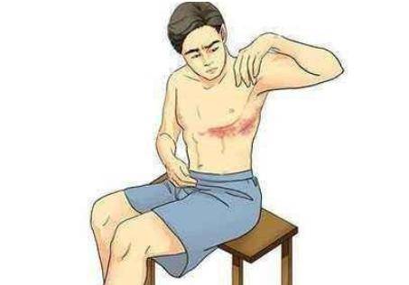 带状疱疹是怎么引起的