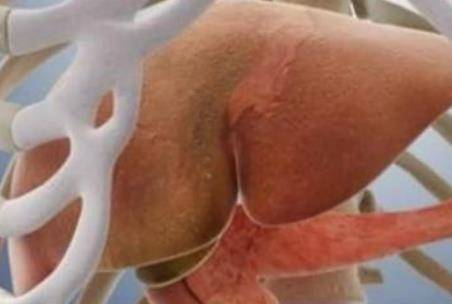 肝癌最多能活多久